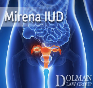 The Threefold Risk or the Mirena IUD