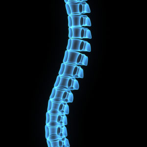 What Kinds of Accidents Can Cause Spinal Cord Injuries?