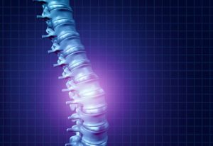 Spinal Fractures, Vertebroplasty, and Kyphoplasty