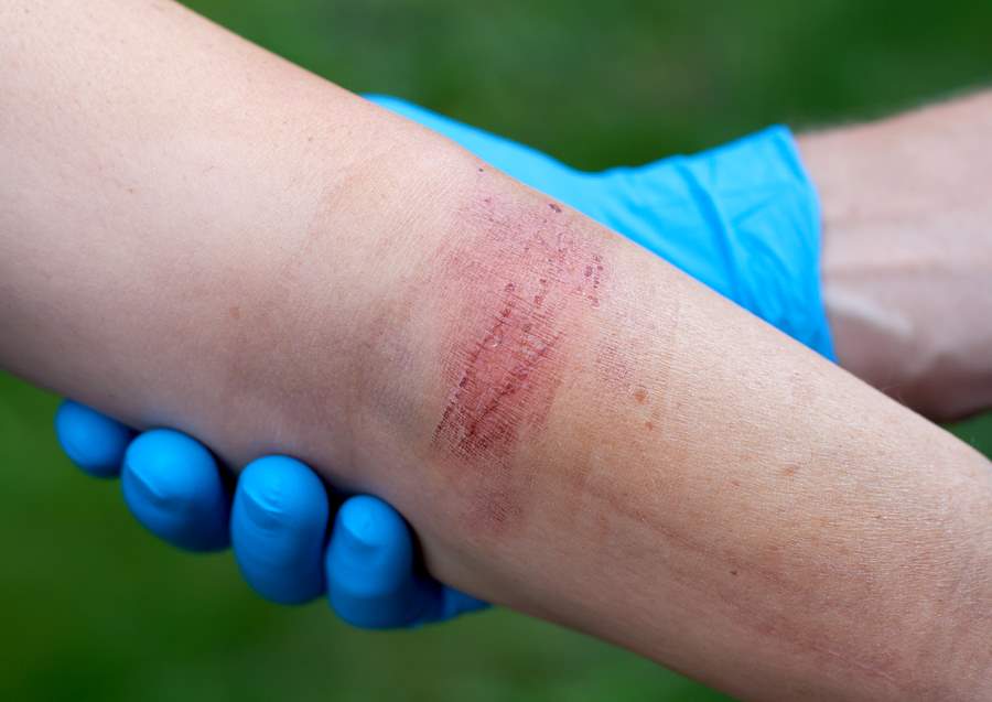 Can I File a Wrongful Death Lawsuit Against My Deceased Spouse’s Employer?