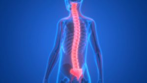 The Ongoing Costs of Spinal Cord Injuries