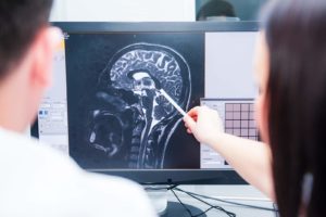Statistics Regarding Traumatic Brain Injuries