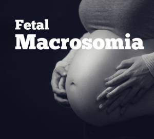 Fetal Macrosomia and Medical Malpractice