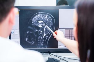 Types of Brain Injuries and Their Severity