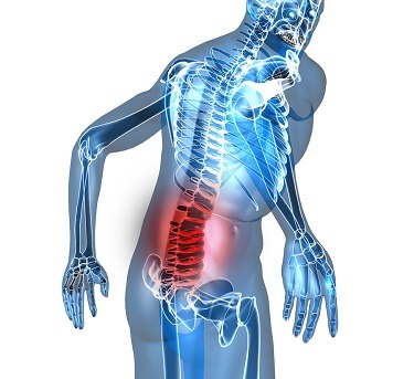 Neck & Lower Back Pain after a Car Accident