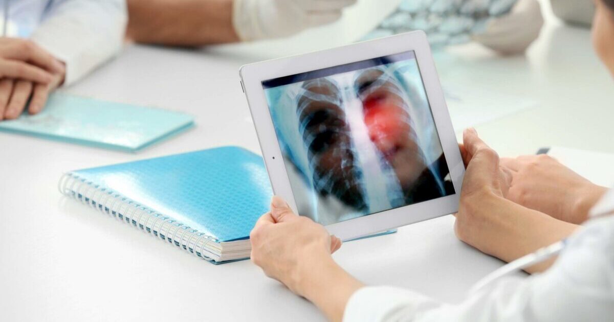 Lung Cancer and Camp Lejeune