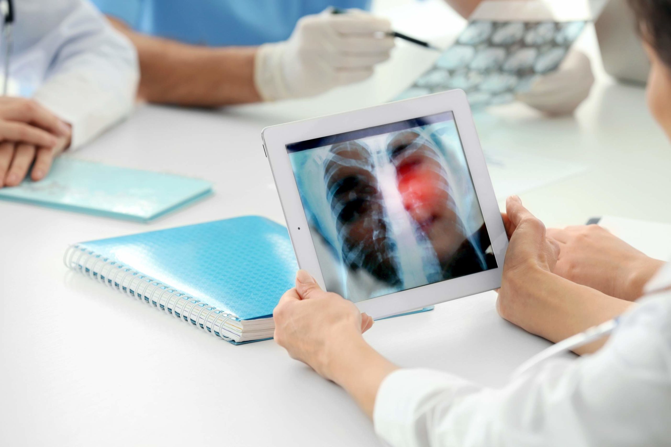 Lung Cancer and Camp Lejeune