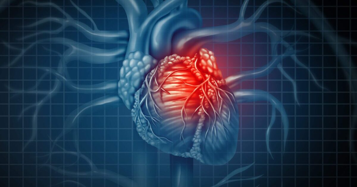Medical Malpractice and Failure to Diagnose Cardiac Conditions