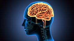 Brain Injury Attorneys Doral, FL