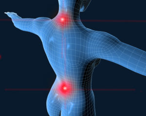 Back and Neck Injury Lawyers in Florida
