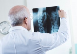 Clearwater Doctor looks at x-ray of victim of Accident that caused a Spinal Cord Injury.