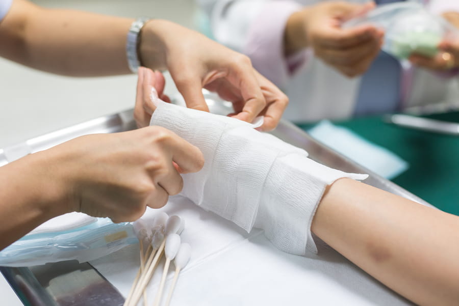 Burn Injury in Miami: Contact an Attorney