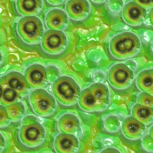 stem cell infection product liability claim lawsuit injury attorney Florida