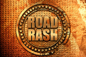 motorcycle accident road rash