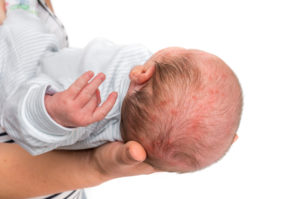 Medical Malpractice Birth Injury Consequences