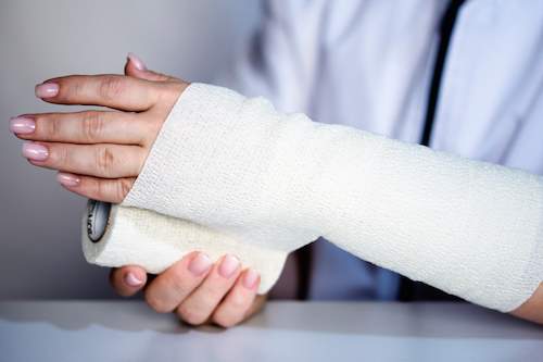 Tampa Burn Injury Attorney Dolmanlaw