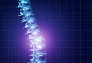 Bronx Spinal Cord Injury Lawyers