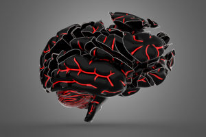 Signs of Brain Damage Dolman Law