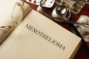 ​How to Choose the Best Mesothelioma Lawyer Near Me