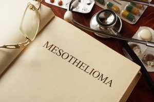 How to Choose the Best Mesothelioma Lawyer Near Me