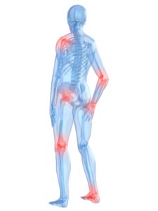 Florida car accident joint injury claim lawsuit Attorney