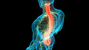 Long Term Spinal Cord Injury Consequences