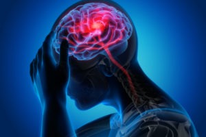Statistics Regarding Traumatic Brain Injuries