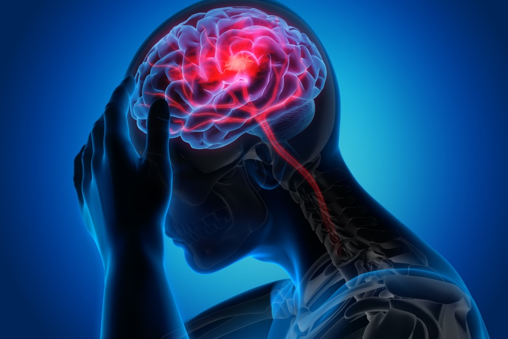 Statistics Regarding Traumatic Brain Injuries