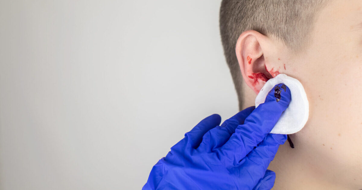 ear injury car accident claim lawsuit attorney lawyer Florida