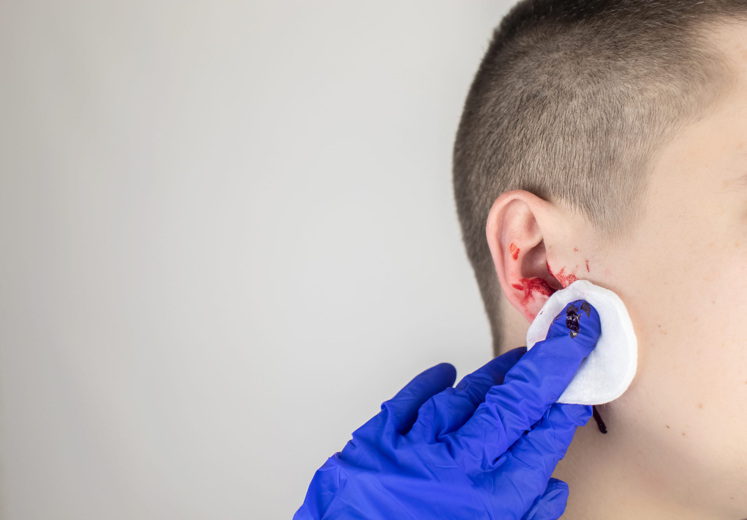 ear injury car accident claim lawsuit attorney lawyer Florida