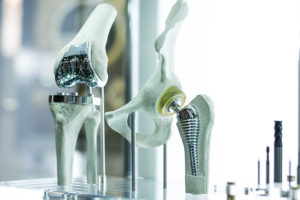 Can I Sue If My Knee or Hip Replacement Device is Recalled?