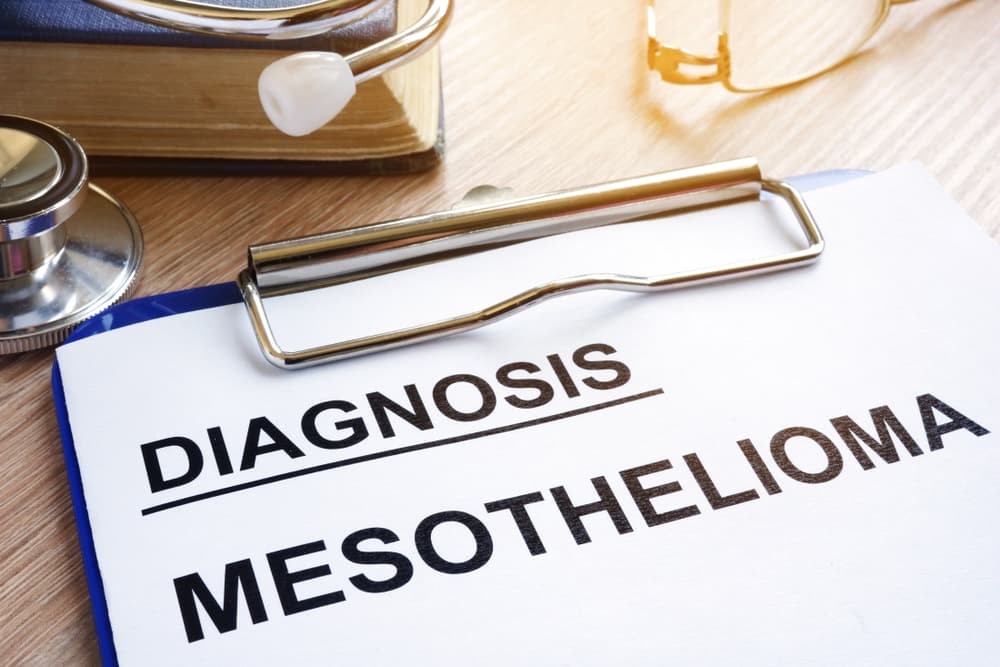 Workers’ Compensation Benefits For Mesothelioma in Clearwater