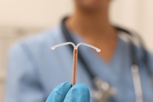 Photo of paragard iud