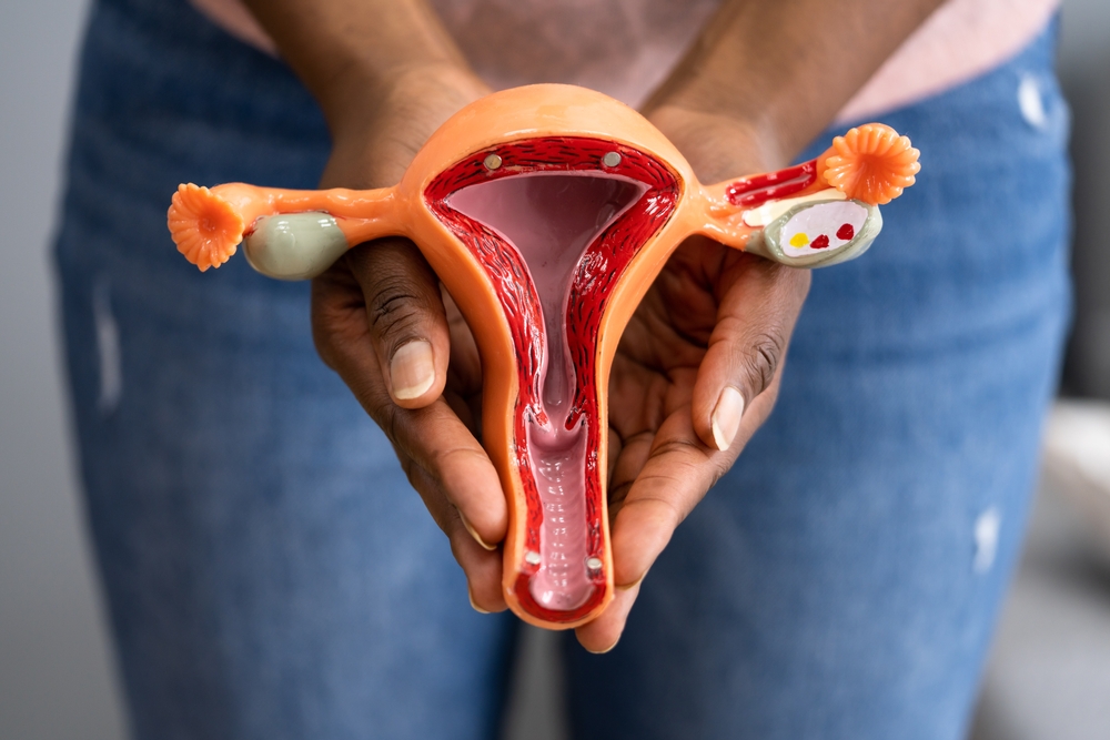 Photo of women holding a uterus model